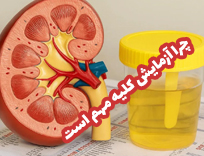 آزمایش کلیه چیست؟ تفسیر کراتینین، اوره و eGFR | آزمایش در شیراز