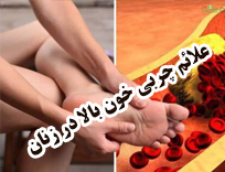 ‫علائم چربی خون بالا در زنان؛ نشانه‌ها، علل، تشخیص و درمان (2026)