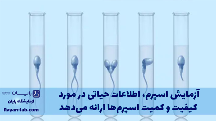 آزمایش اسپرم چیست