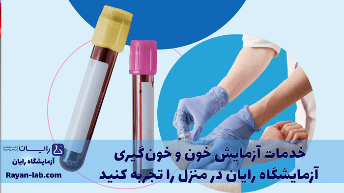 کدام آزمایش خون نیاز به ناشتایی ندارد؟